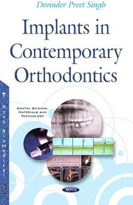 Implants in contemporary orthodontics.. DIAYTAR Nigeria: Where affordability meets speed and quality.