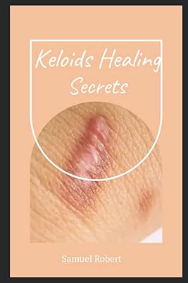 Healing secrets of the Chélooids.. Discover a new way to shop with DIAYTAR NIGERIA's comprehensive marketplace and quick delivery options.