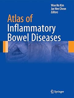 Atlas of inflammatory intestine diseases.. DIAYTAR NIGERIA: Your affordable gateway to thousands of products delivered within a week.