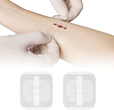 Surgical repair of the seamless ligament Quick node emergency closing device for wounds.. From essentials to electronics, DIAYTAR Nigeria ships your order in no time.