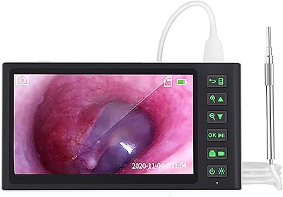 Digital otoscope with 7 -inch IPS screen Inspection endoscope of 39.. Shop with confidence at DIAYTAR NIGERIA, enjoying competitive prices and delivery within 8 days.