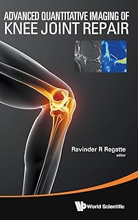 Advanced quantitative imaging of the repair of the knee joint.. Skip the lines and shop online — DIAYTAR Nigeria delivers to your door in days.