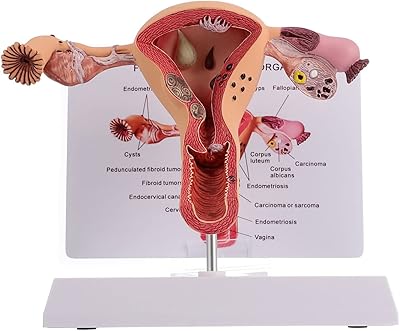 Model of female genital anatomy 1 Pathological anatomical model of the uterus and ovary.. Affordable choices, delivered fast — that's the DIAYTAR Nigeria promise.