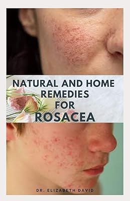 Natural remedies and house against rosacea: a self-assistance guide to prevent and completely treat rosacea.. DIAYTAR Nigeria combines variety, affordability, and speed — making your online shopping experience not only enjoyable but also cost-effective.