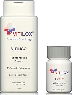 Vitiligo vitilox® pigmentation cream and immunotherapy capsules T-Cell-V.. Shop with confidence at DIAYTAR NIGERIA, Nigeria's premier affordable e-commerce platform.