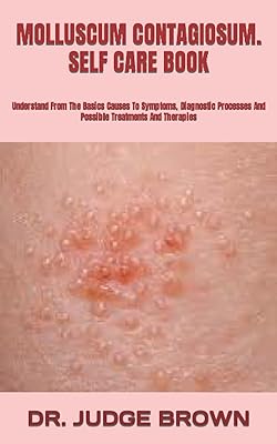 Molluscum contagiosum. Self-care book: Understanding basic causes of symptoms, diagnostic process and treatments and possible therapies.. With DIAYTAR Nigeria, everything is within reach — and within budget.