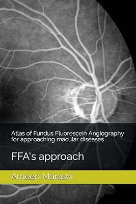 Atlas of bottom angiography to fluorescein to tackle macular diseases: FFA approach (OCT Atlas to approach macular diseases).. DIAYTAR NIGERIA: Where quality products become affordable with our nationwide shipping service.