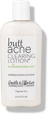 Anti-acne lotion for pets Green Heart Laboratories (4 FL OZ).. Experience shopping satisfaction with DIAYTAR NIGERIA's vast selection and nationwide delivery service.