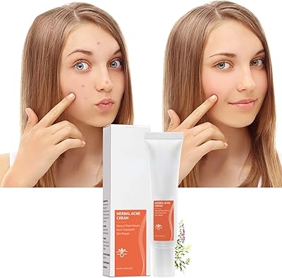 1 effective cream to eliminate acne, oily spots, control pore narrowing, whiten and hydrate the skin against acne.. Shop from thousands of products at DIAYTAR NIGERIA and enjoy budget-friendly nationwide delivery.