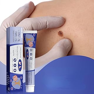 1pcs Anti-Verrues Flat Handlestry Anti-Verrues Aposting Handlest Eye For Cori Eyes Flat, The cream against warts is safe and effective suitable for sensitive skin to eliminate warts, 20g.. DIAYTAR NIGERIA bridges the gap between desire and affordability with nationwide delivery in under 8 days.