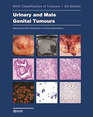 WHO classification of the tumors of the urinary system and the male genitals.. Discover thousands of products on DIAYTAR Nigeria — from fashion and electronics to home goods. We guarantee quick delivery and competitive pricing across the board.