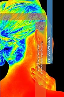 Thermography applied to integrative medicine.. DIAYTAR NIGERIA: Redefining online shopping with unbeatable prices and consistent delivery times.