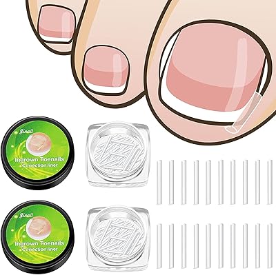Correction strips Incarnate nails curved patches embodied recovery clips pedicure and pedicure tool.. Shop with confidence at DIAYTAR NIGERIA, enjoying competitive prices and delivery within 8 days.