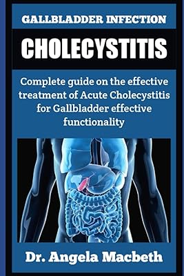 Infection of the gallbladder: cholecystitis: Complete guide on the effective treatment of acute cholecystitis for an effective functionality of the gallbladder... You deserve better shopping — choose DIAYTAR Nigeria today.