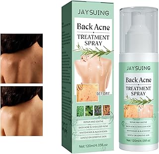 Acne -of -back treatment spray, spray against acne of the herbal back, spray against acne at 2 % salicylic acid for the back and the body (2 pieces).. From daily deals to exclusive products — DIAYTAR Nigeria has you covered.