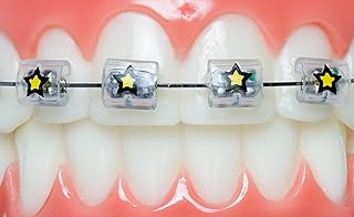 Brasz wax replacement support cover, bumper protector, Snap-Cap Star 10-piece orthodontic accessories.. From household needs to gadgets, DIAYTAR Nigeria has it all.