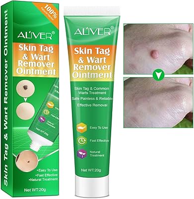 Anti-Verrues cream for the elimination of warts, advanced treatment formula for the elimination of warts and beauty grains, natural ingredients, treatment for all skin types, 20g.. Everyday deals, every category — only on DIAYTAR Nigeria.
