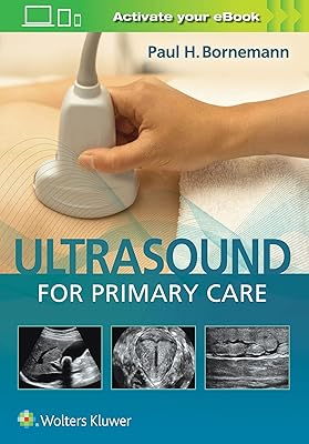 Ultrasound for primary care.. Experience the convenience of boundless shopping with DIAYTAR NIGERIA's vast selection and quick delivery.