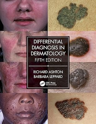 Differential diagnosis in dermatology.. DIAYTAR NIGERIA brings quality products to every corner of Nigeria at prices everyone can afford.