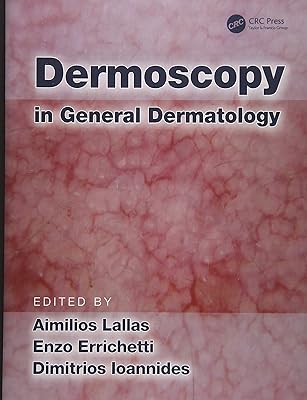 Dermoscopy in general dermatology.. Transform your online shopping experience with DIAYTAR NIGERIA's affordable and diverse marketplace.